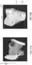 Fig. 22 - Method and apparatus for three dimensional reconstruction of a joint using ultrasound