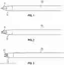 Fig. 02 - Devices and methods for soft tissue biopsy and tissue sample collection