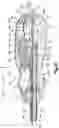 Fig. 05 - Vascular closure device