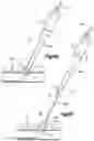 Fig. 14 - Vascular closure device