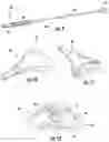 Fig. 06 - METHODS AND DEVICES FOR TRANSXIPHOID ACCESS TO THE MAMMARY ARTERIES