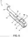 Fig. 06 - Surgical access system and methods