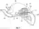 Fig. 02 - ORGAN RETRACTOR