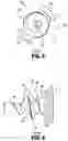 Fig. 03 - Surgical fastener applying device, kits and methods for endoscopic procedures