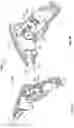 Fig. 09 - Surgical device having multiple drivers
