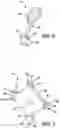 Fig. 04 - Orthopedic fixation system and method of use thereof