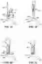 Fig. 08 - Orthopedic fixation system and method of use thereof