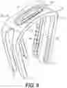 Fig. 07 - Superelastic bone compression staple in staple system