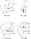 Fig. 131 - Systems and methods for increased operating room efficiency
