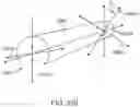 Fig. 149 - Systems and methods for increased operating room efficiency