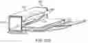 Fig. 85 - Systems and methods for increased operating room efficiency