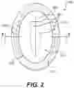 Fig. 03 - ABDOMINAL WALL TREATMENT DEVICES