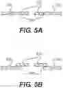 Fig. 06 - ABDOMINAL WALL TREATMENT DEVICES