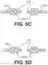 Fig. 07 - ABDOMINAL WALL TREATMENT DEVICES