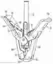 Fig. 01 - System for fixation of leaflets of a heart valve