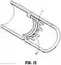 Fig. 10 - Surgical stapling apparatus with anvil buttress
