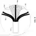 Fig. 09 - Vascular occlusion device