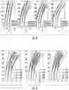 Fig. 08 - Steerable drill for minimally-invasive surgery