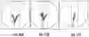 Fig. 12 - Steerable drill for minimally-invasive surgery