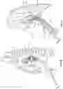 Fig. 06 - Diaphragm entry for posterior surgical access