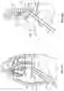 Fig. 09 - Diaphragm entry for posterior surgical access