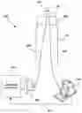 Fig. 01 - Systems And Methods For Navigating, Opening And Cleaning Plaque Or Total Occlusion In Arteries