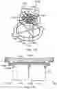 Fig. 15 - Surgical system sterile drape