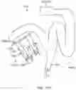 Fig. 16 - Surgical system sterile drape