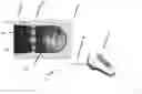 Fig. 01 - Fully integrated, disposable tissue visualization device
