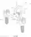 Fig. 20 - SPINAL IMPLANT AND METHOD