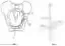 Fig. 02 - ACETABULAR COMPRESSION PLATE WITH DUAL CORTICAL FIXATION AND METHOD OF FIXING THEREOF