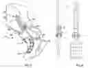 Fig. 04 - ACETABULAR COMPRESSION PLATE WITH DUAL CORTICAL FIXATION AND METHOD OF FIXING THEREOF