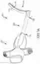Fig. 02 - Adjustable clamp systems and methods