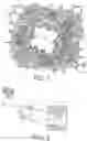 Fig. 02 - Thoracoscopic methods for treatment of bronchial disease