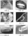 Fig. 02 - System for inducing desirable temperature effects on body tissue