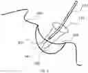 Fig. 03 - DENTAL SPLATTER SHIELD WITH FLUIUD ABSORPTION AND LIGHT REFLECTION
