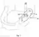 Fig. 08 - Drill guide