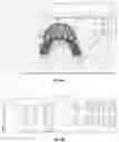 Fig. 07 - Dental arch width measurement tool