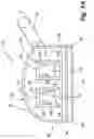 Fig. 02 - Reduced-Friction Buccal Tube and Method of Use