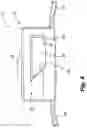 Fig. 06 - Reduced-Friction Buccal Tube and Method of Use