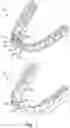 Fig. 02 - Methods for generating orthodontic models having bite adjustment structures