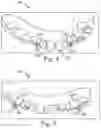 Fig. 06 - Methods for generating orthodontic models having bite adjustment structures