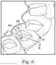 Fig. 07 - Methods for generating orthodontic models having bite adjustment structures