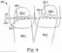 Fig. 09 - Methods for generating orthodontic models having bite adjustment structures