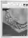 Fig. 01 - A METHOD AND SYSTEM OF IDENTIFYING A DENTAL IMPLANT FOR AN OPTIMIZED IMPLANT SITE