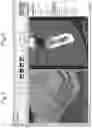 Fig. 03 - A METHOD AND SYSTEM OF IDENTIFYING A DENTAL IMPLANT FOR AN OPTIMIZED IMPLANT SITE