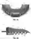 Fig. 04 - Devices and methods for oral hygiene