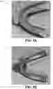 Fig. 12 - Devices and methods for oral hygiene