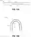 Fig. 23 - Devices and methods for oral hygiene