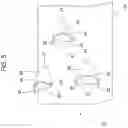 Fig. 06 - Atraumatic high-volume dental evacuation tip